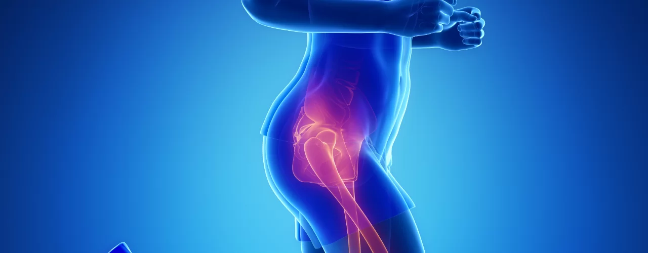 Hip Pain Relief Triumph Physical Therapy University Place, WA